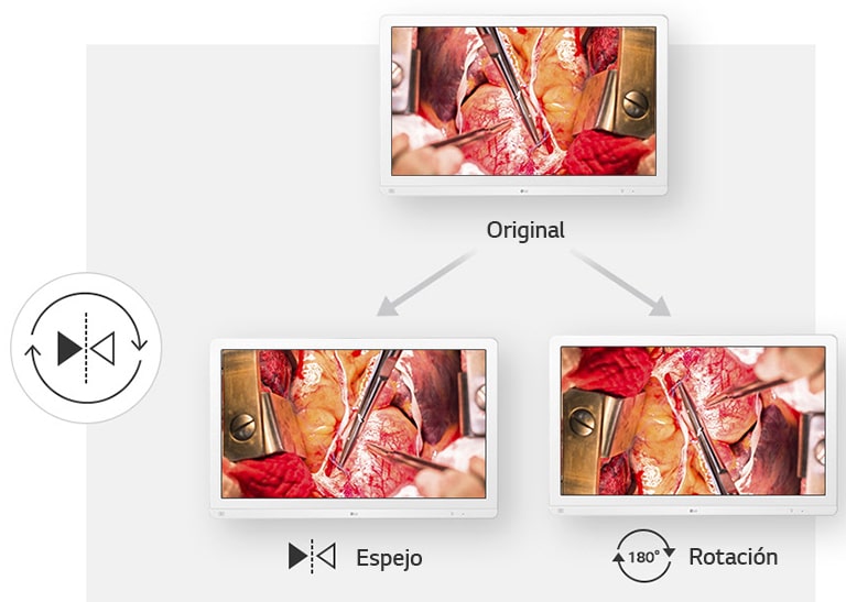 Encuentra la visión perfecta para operar2