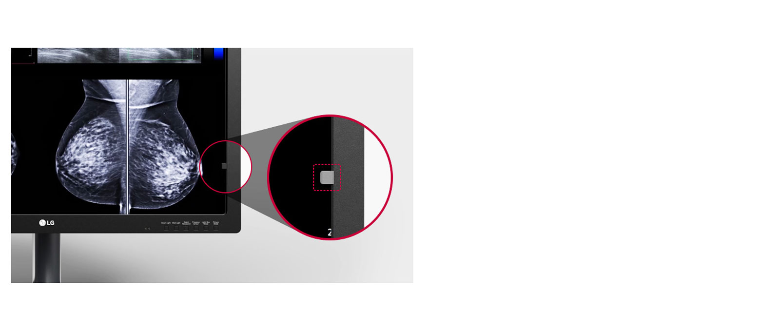 Consistencia en Imágenes Médicas