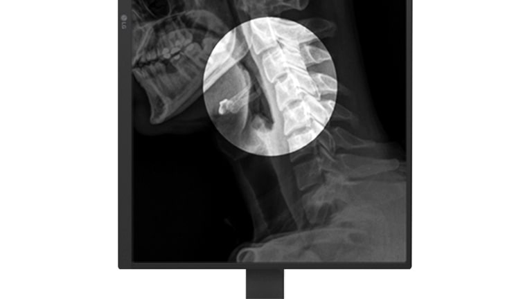 El 27HS713C cuenta con el Modo de Vista de Enfoque, que resalta partes específicas de la imagen médica. Los usuarios pueden seleccionar y enfocarse fácilmente en áreas de interés, mientras oscurecen el resto de la pantalla."