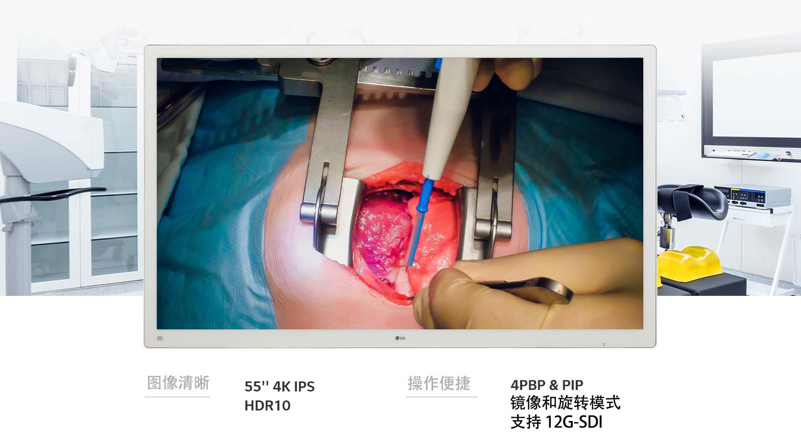 LG 55 英寸 4K IPS 手术显示器 55MH5K 在画质与操作便捷性方面提升至另一个高度。