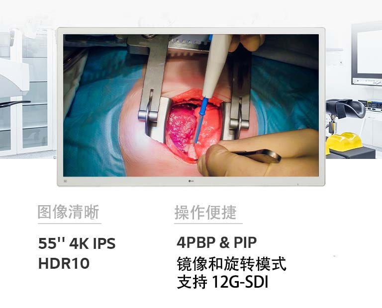 LG 55 英寸 4K IPS 手术显示器 55MH5K 在画质与操作便捷性方面提升至另一个高度。