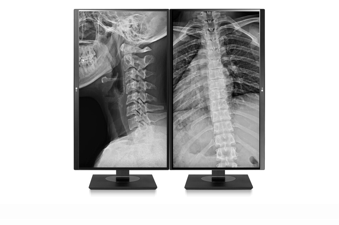 LG 27'' LG 8MP 临床显示器, 27HJ713C, thumbnail 11