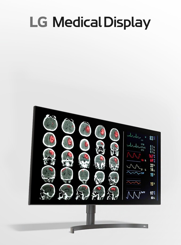 LG31.5'' 8MP 诊断显示器