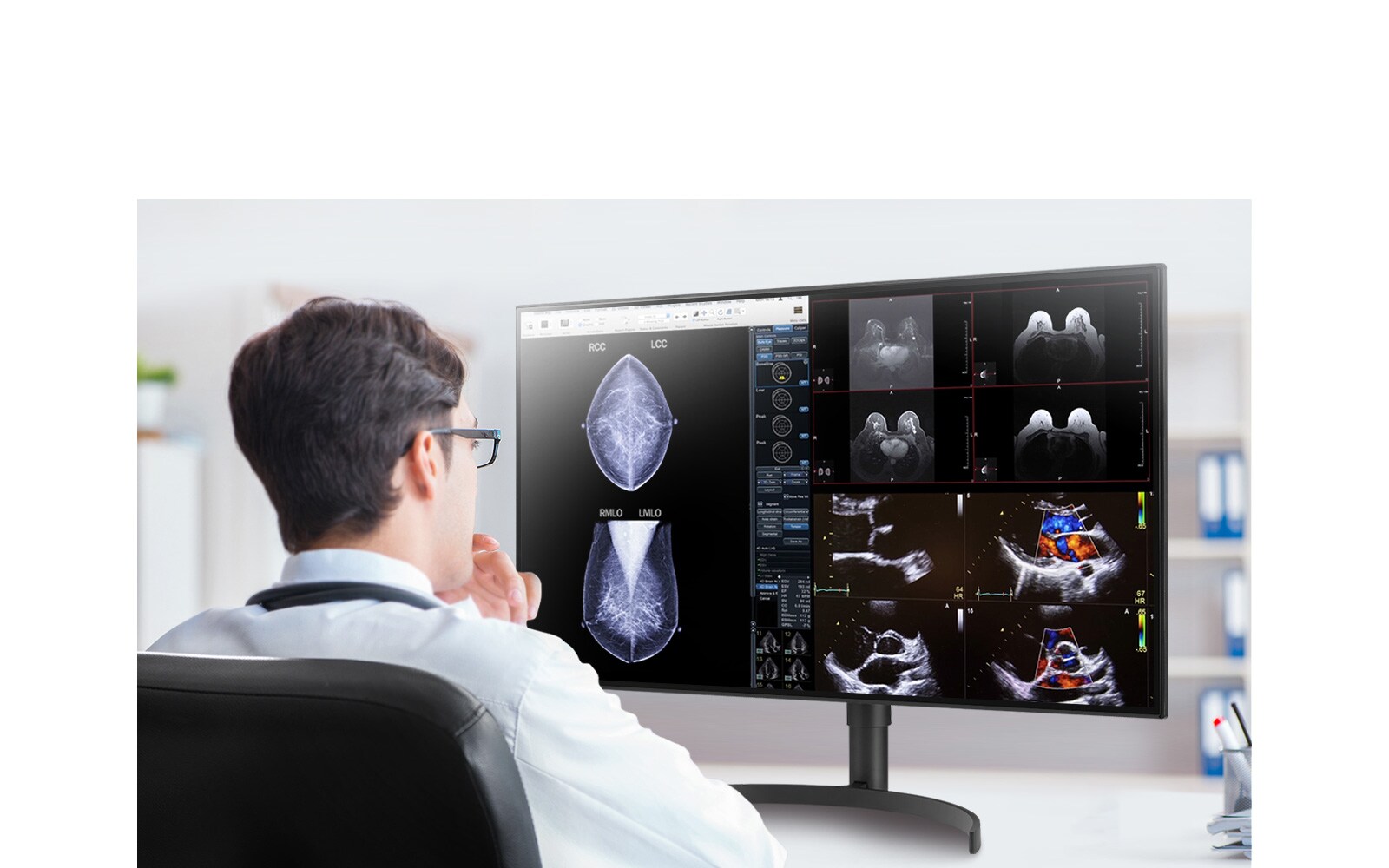 31.5英寸800万像素IPS显示屏和178°宽视角让患者和医生能够多角度观察图像。