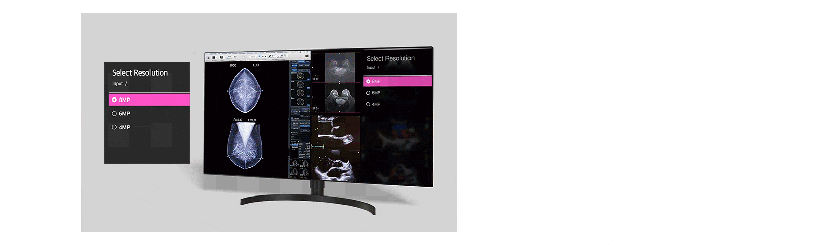 多分辨率模式，用户可在4MP、6MP和8MP输入之间选择分辨率