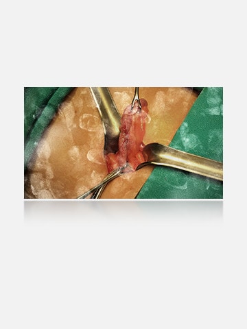 左图显示器呈现明显指纹与污渍，阻碍视野。