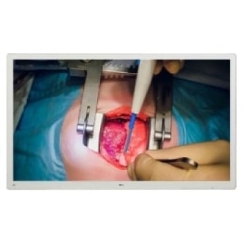 Front view with infill image1