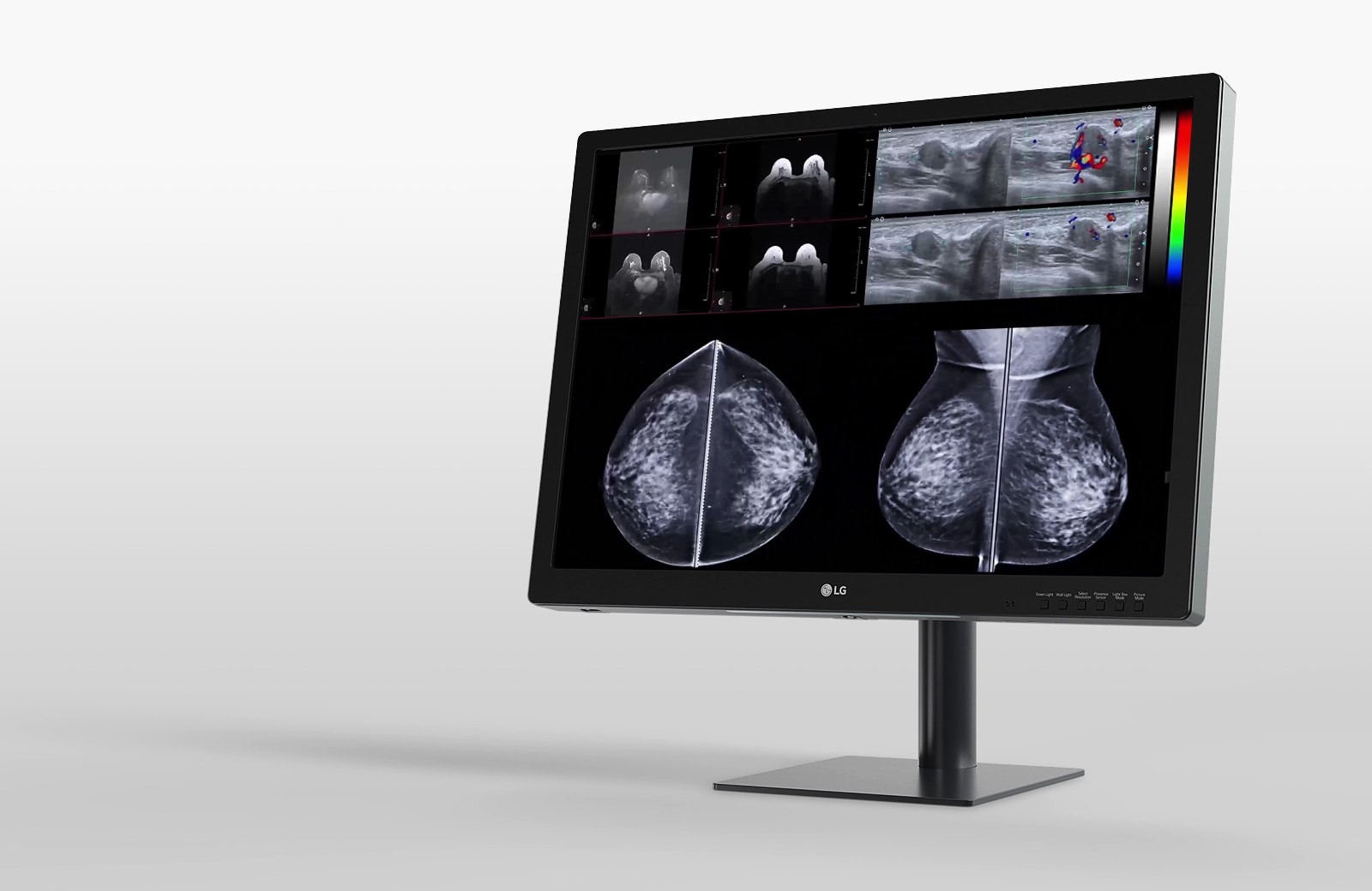 LG 31 英寸 12 兆像素 IPS 显示器，专为乳腺成像设计，提供简化的工作流程和提升的舒适度 