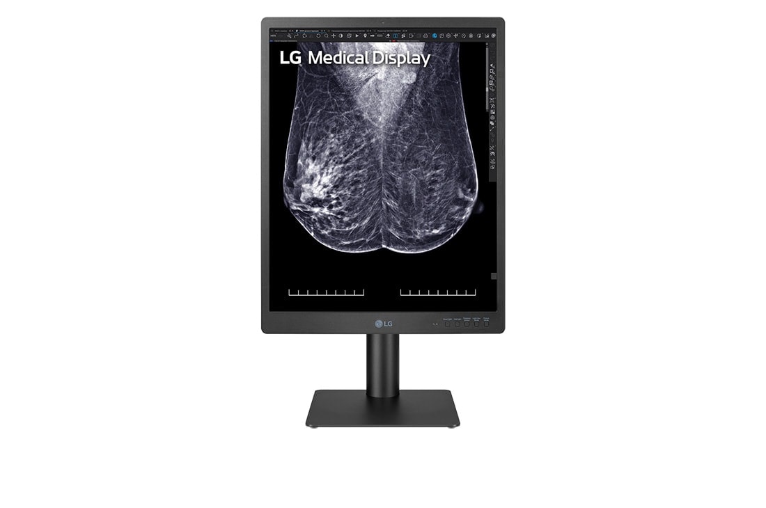 LG 21.3 英寸 5MP IPS 乳腺成像专用诊断显示器, front view, 21HQ613D-B