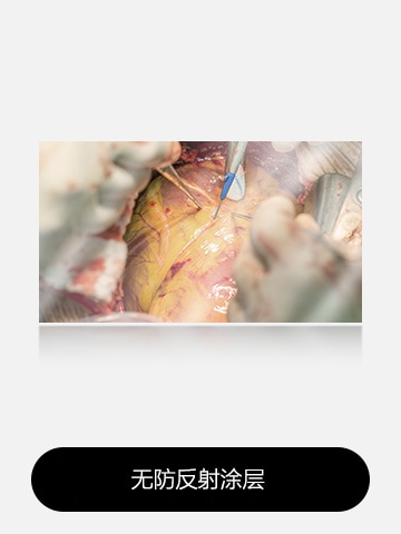 The left image shows a display without anti-reflection, with more glare and reflections affecting visibility. 	