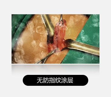 左图显示器呈现明显指纹与污渍，阻碍视野。