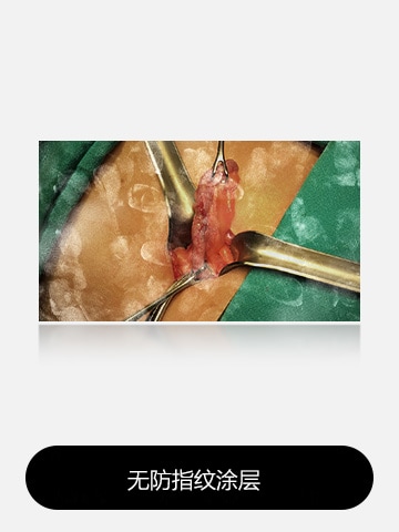 左图显示器呈现明显指纹与污渍，阻碍视野。