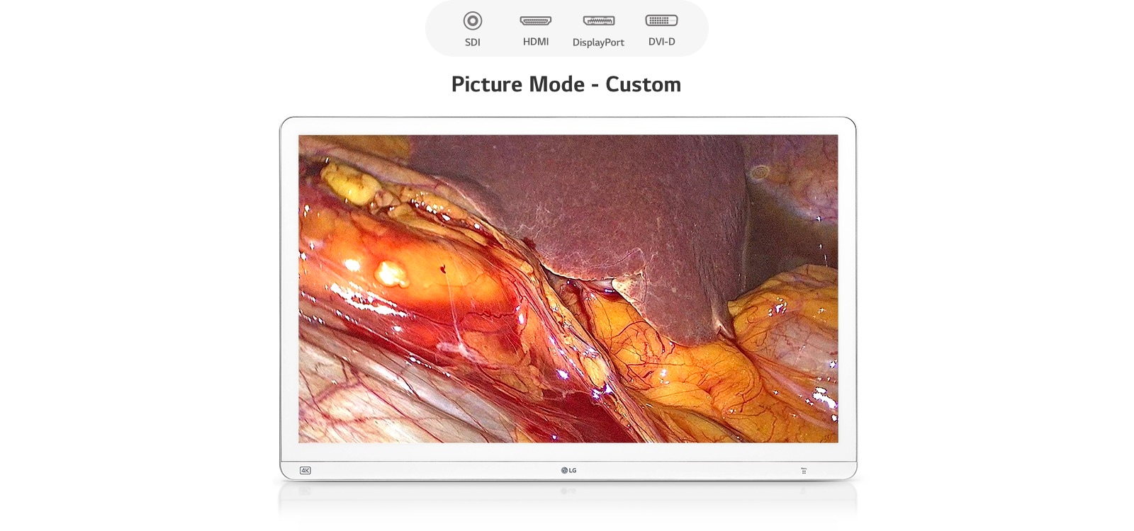 视频展示了医用显示器根据不同输入源（如 SDI、HDMI、DisplayPort 和 DVI-D）调整画面模式，以提升各种手术视频的清晰度。