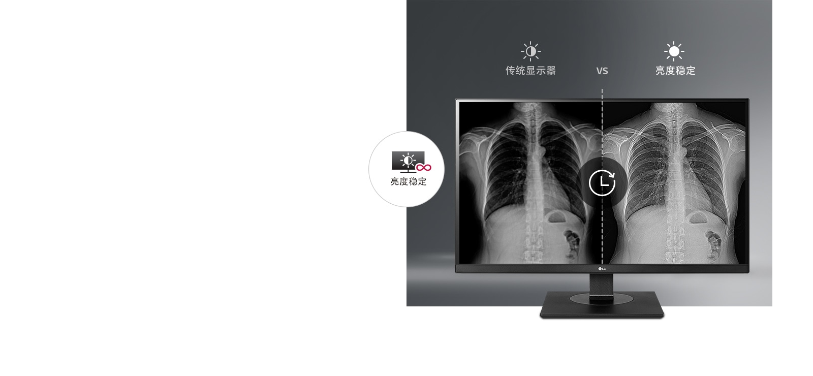 始终如一的稳定显示1