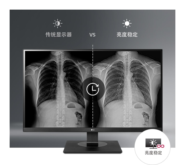 始终如一的稳定显示2