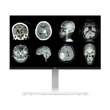 27" 8MP 临床显示器1