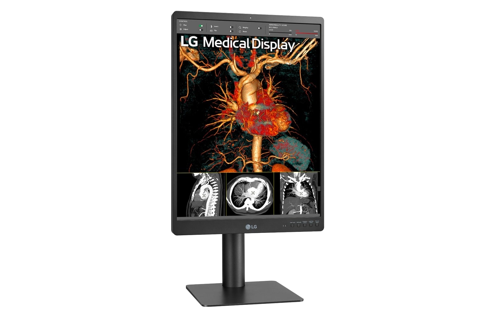 LG 21.3'' 3MP IPS Diagnostic Monitor, 21HQ513D-B