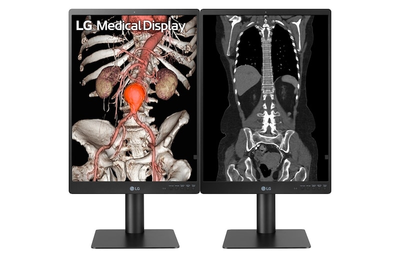 LG 21.3'' 3MP IPS Diagnostic Monitor, 21HQ513D-B