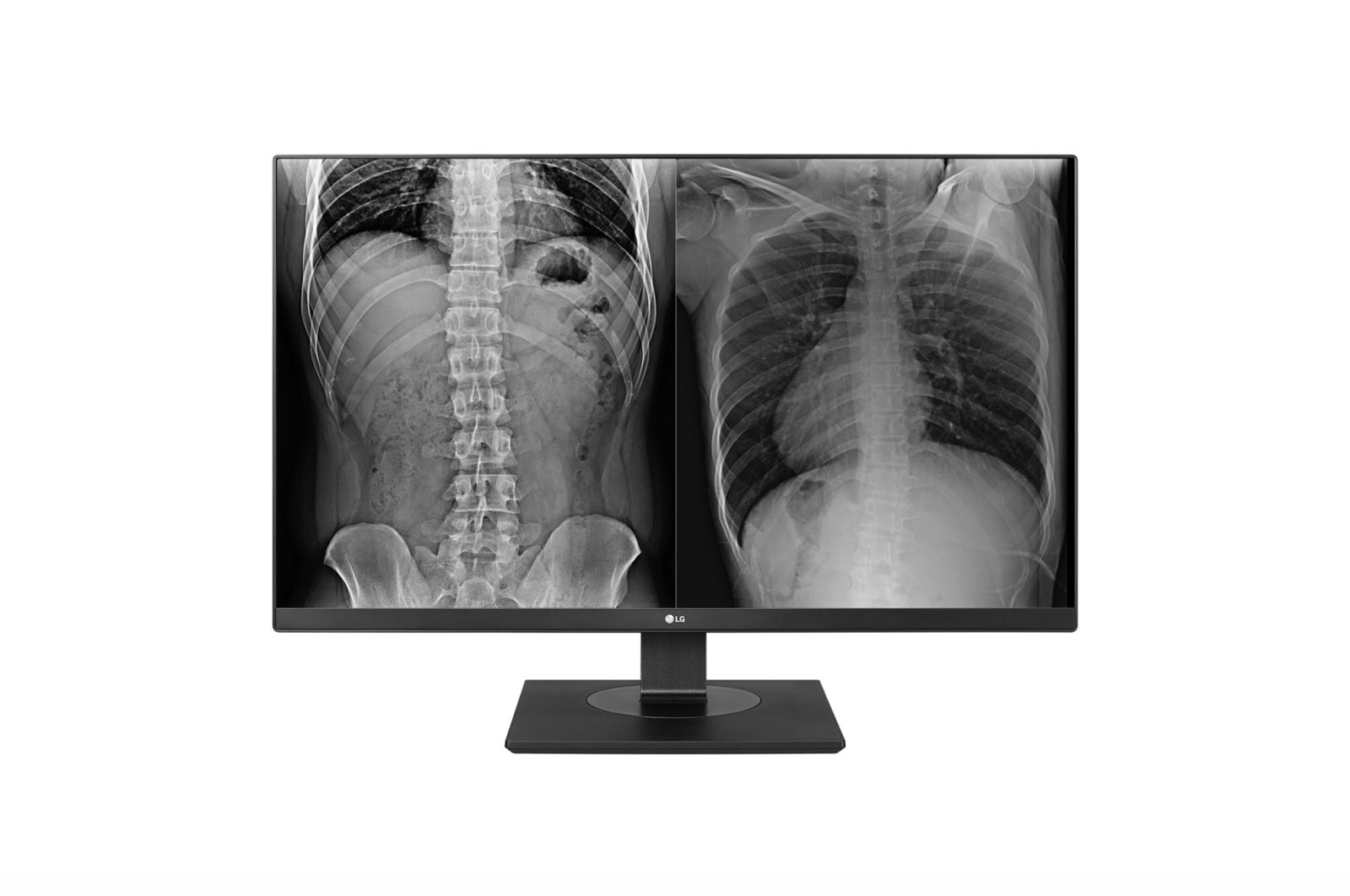 Front view of 27” UHD IPS Clinical Review Monitor 27HJ713C-B