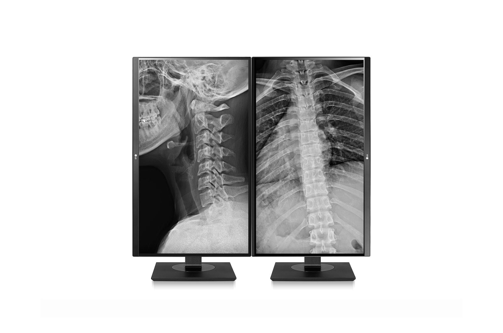 LG 27” UHD IPS Clinical Review Monitor, 27HJ713C-B