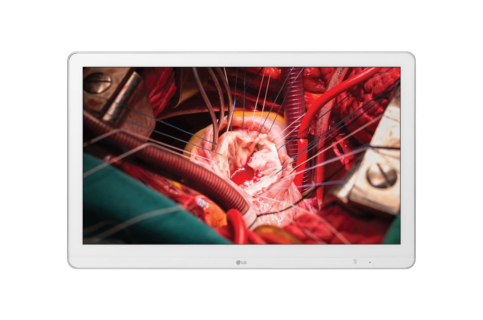 Front view of LG Full HD Surgical Monitor 27HK510S-W