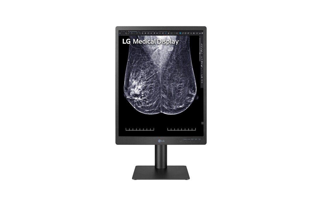 LG 21.3-inch 5MP IPS Diagnostic Monitor for Mammography, 21HQ613D-B