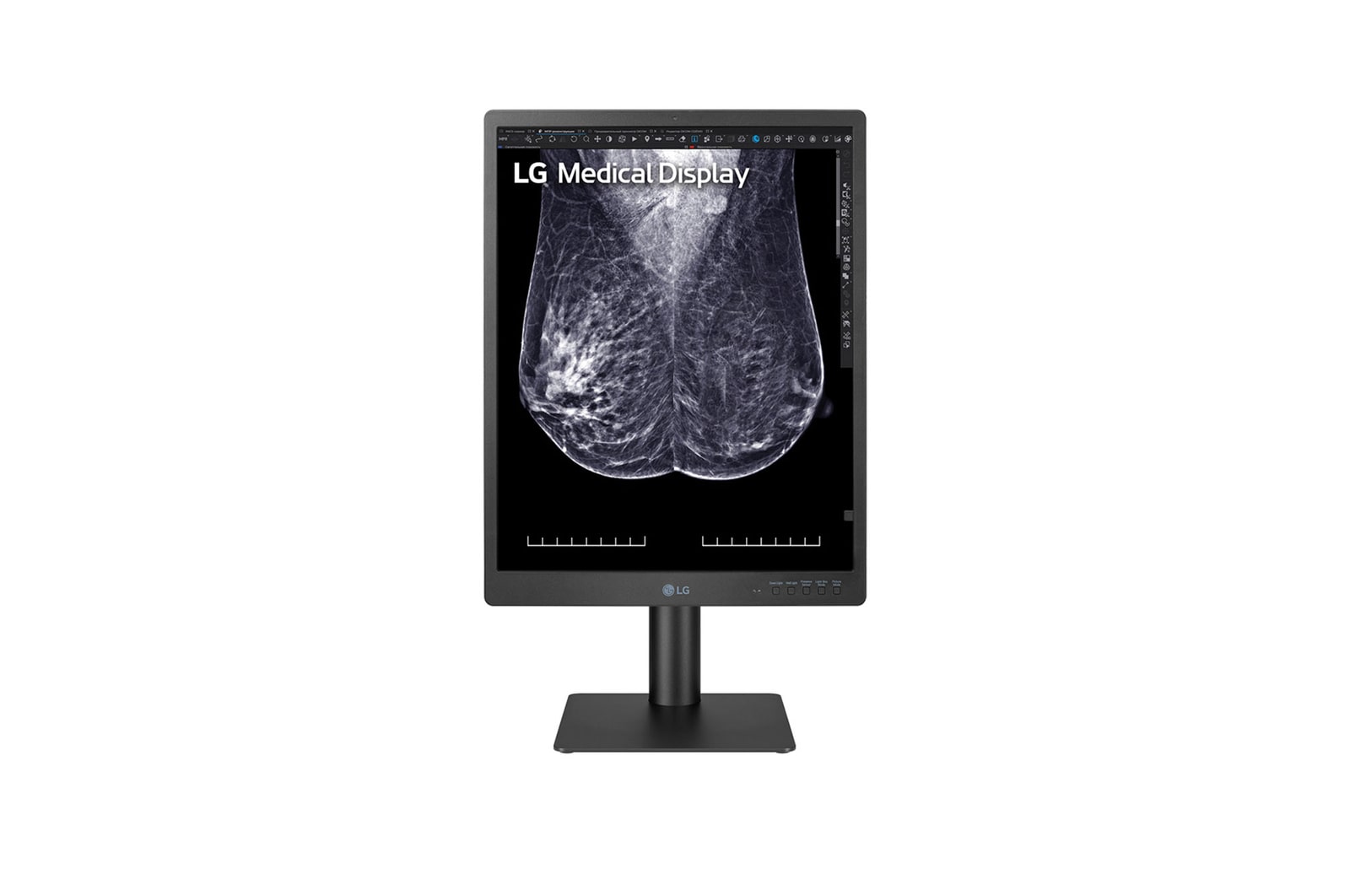 LG 21.3-inch 5MP IPS Diagnostic Monitor for Mammography, 21HQ613D-B
