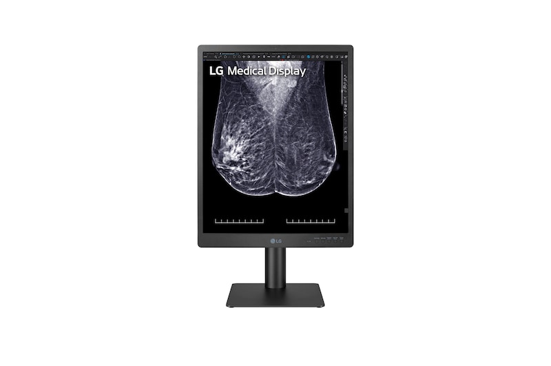 LG 21.3-inch 5MP IPS Diagnostic Monitor for Mammography, 21HQ613D-B