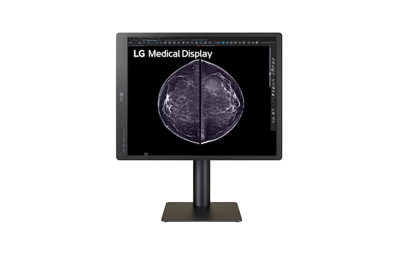 LG 21.3-inch 5MP IPS Diagnostic Monitor for Mammography, 21HQ613D-B