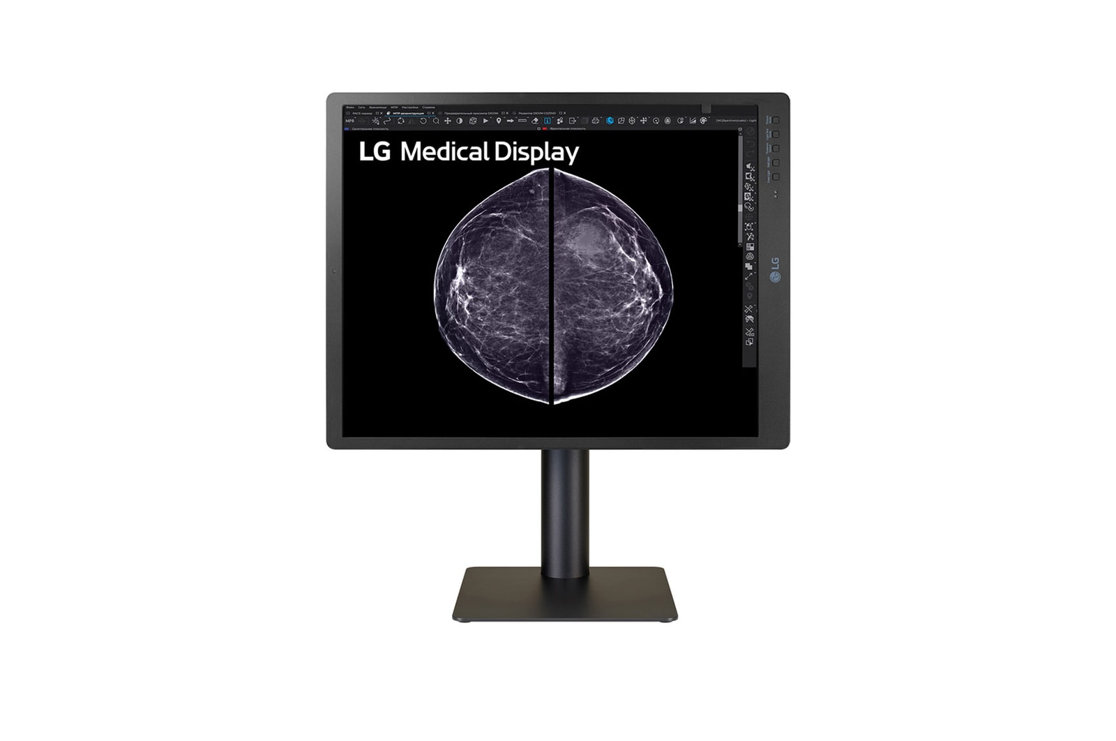 LG 21.3-inch 5MP IPS Diagnostic Monitor for Mammography, 21HQ613D-B