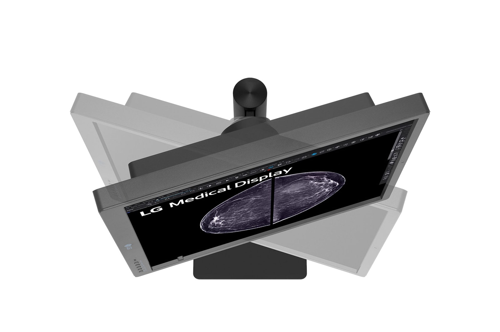 LG 21.3-inch 5MP IPS Diagnostic Monitor for Mammography, 21HQ613D-B