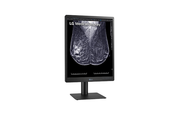 LG 21.3-inch 5MP IPS Diagnostic Monitor for Mammography, 21HQ613D-B