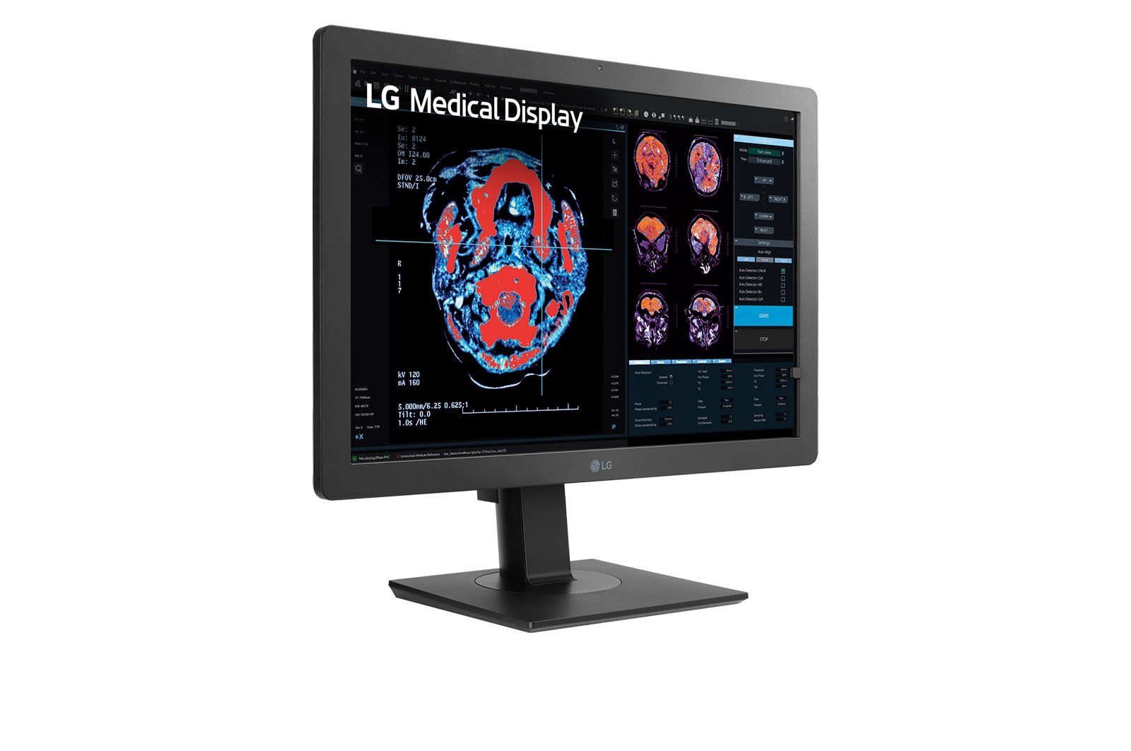 LG 24” 2MP IPS Clinical Review Monitor, 24HR513C-B