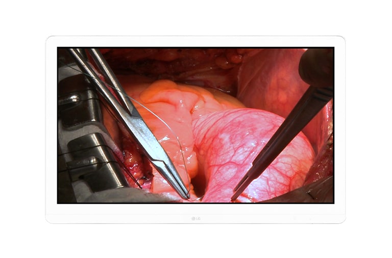 Front view of 27&#34; Ultra HD Surgical Monitor 27HJ710S