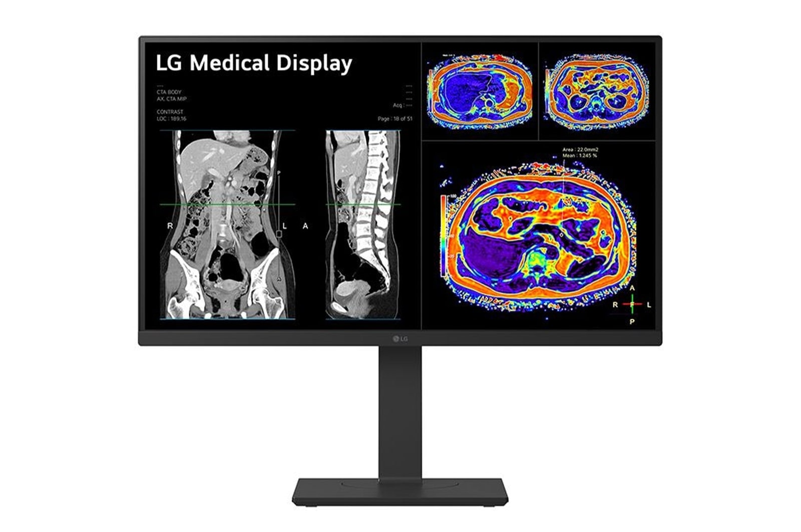 LG 27” 8MP IPS Clinical Review Monitor, 27HS713C-B