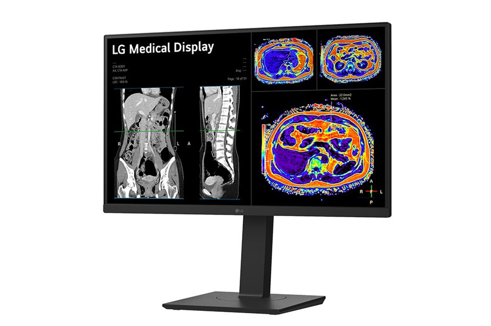 LG 27” 8MP IPS Clinical Review Monitor, 27HS713C-B