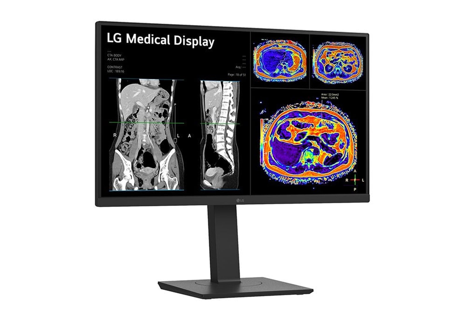 LG 27” 8MP IPS Clinical Review Monitor, 27HS713C-B