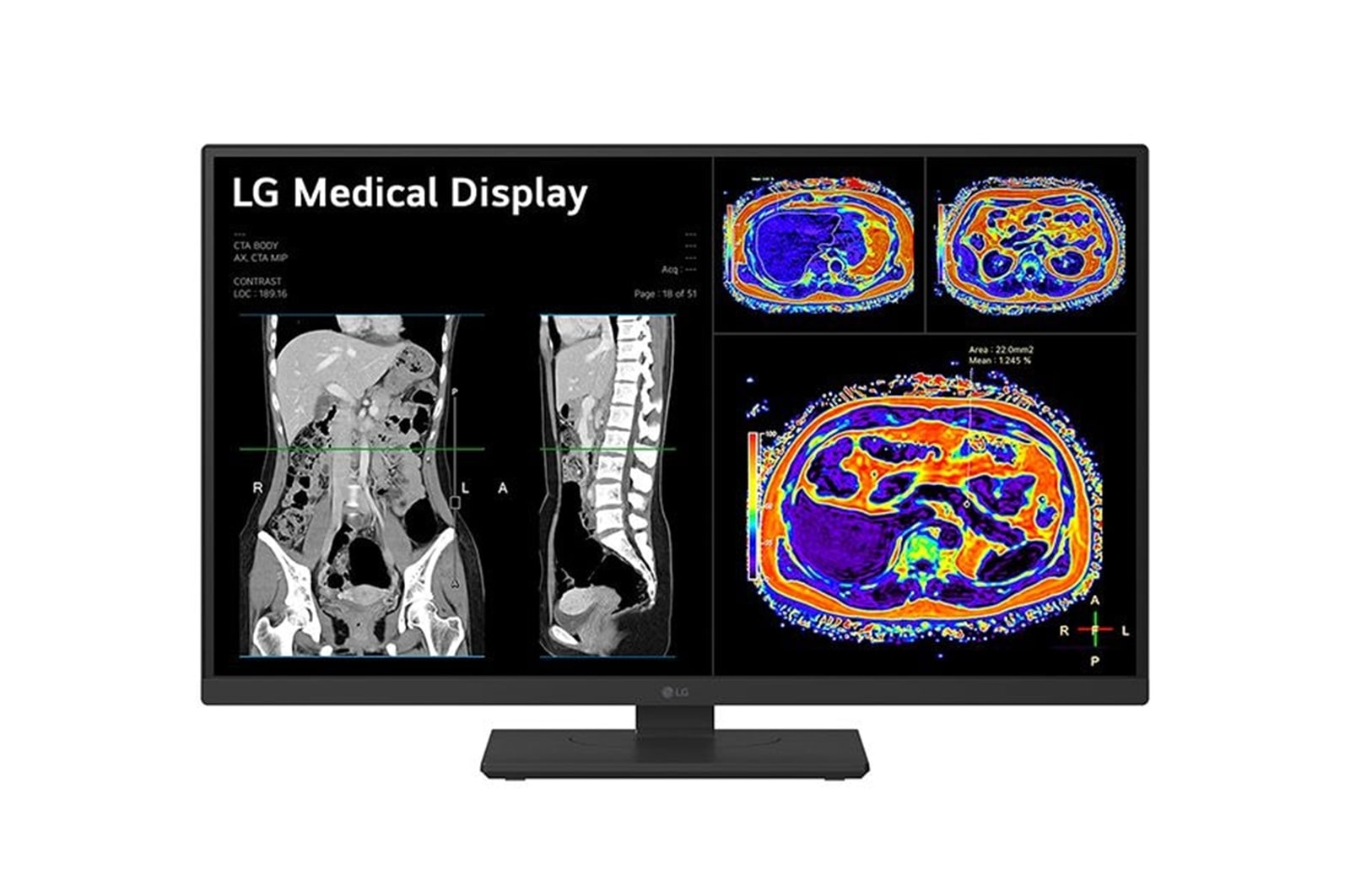 LG 27” 8MP IPS Clinical Review Monitor, 27HS713C-B