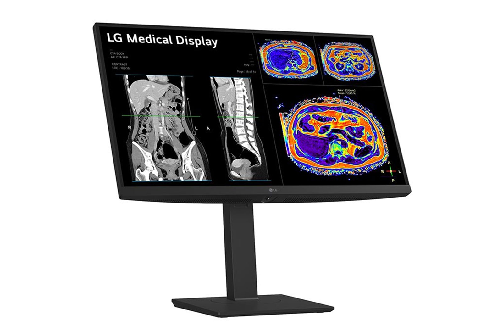 LG 27” 8MP IPS Clinical Review Monitor, 27HS713C-B
