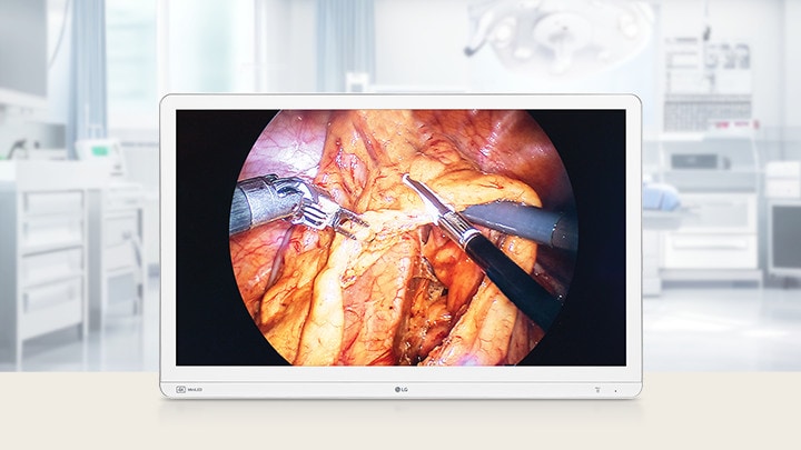 31.5-inch 4K Mini-LED surgical monitor displaying a high-resolution surgical procedure, designed for precision in medical environments.	