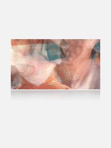 The left image shows a display without anti-glare, where reflections and glare obscure the view.	