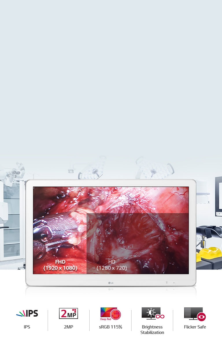 Um monitor otimizado para cirurgias 1