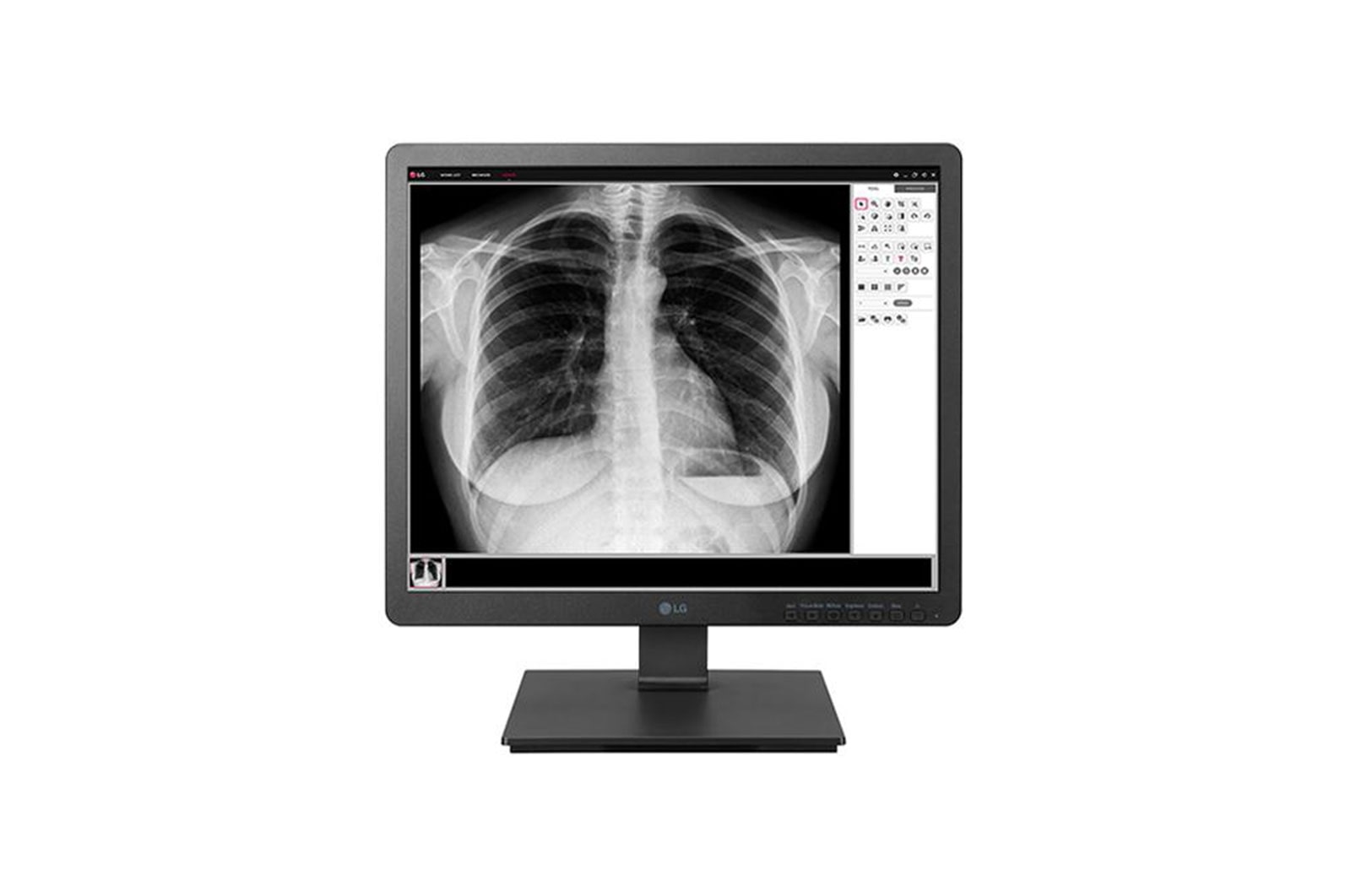 Vista frontal de 19&#34; 1280 x 1024 Monitor Médico LG de 1,3 MP 19HK312C-B