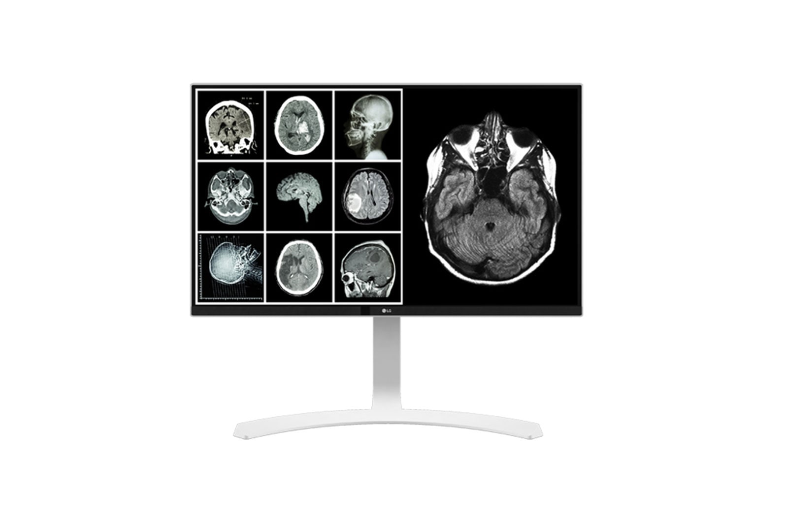Vista frontal de 27” Monitor Médico LG 8MP (4K) Branco 27HJ712C