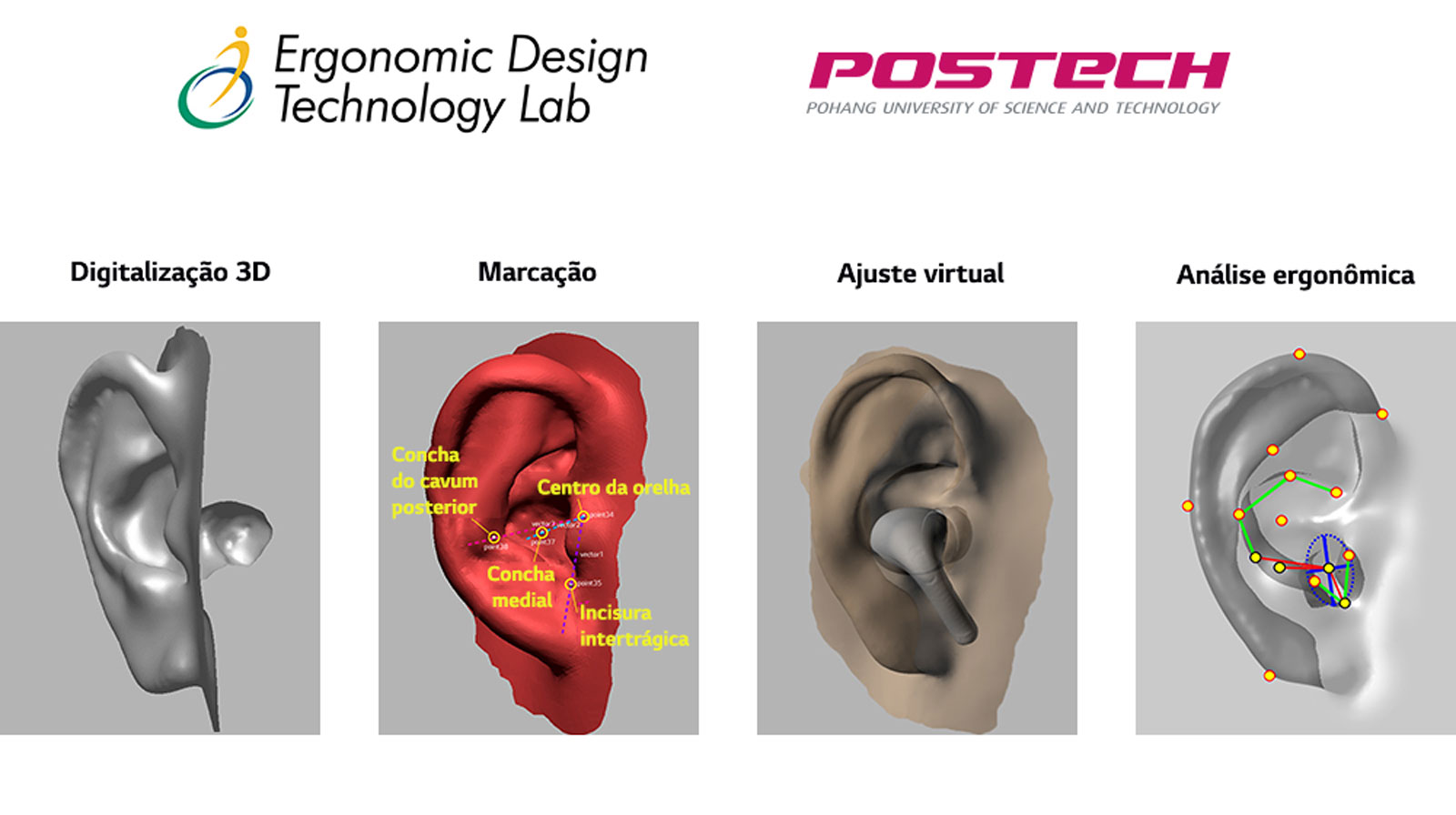 Imagem mostrando o desenvolvimento da modelagem da orelha em 3D em um total de 4 etapas.