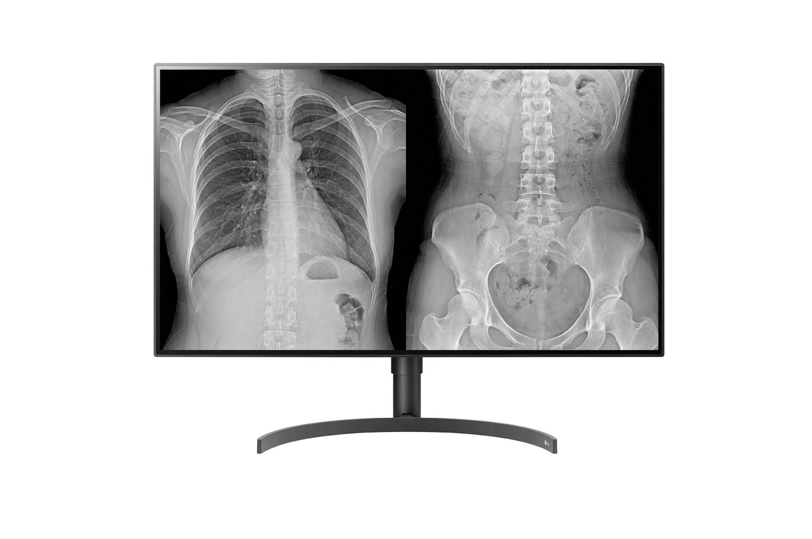 LG Monitor Médico IPS de 31,5'' e 8 MP (3840 x 2160) com modos multirresolução (4/6/8 MP) e de patologia clínica,  PBP/controlador duplo e suporte ergonômico, 32HL512D-B