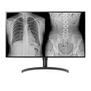 LG Monitor Médico IPS de 31,5'' e 8 MP (3840 x 2160) com modos multirresolução (4/6/8 MP) e de patologia clínica,  PBP/controlador duplo e suporte ergonômico, 32HL512D-B