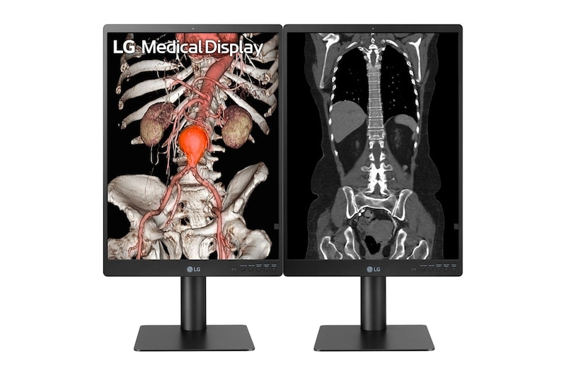 LG Monitor de diagnóstico LG IPS 21,3'' 3 MP, 21HQ513D-B