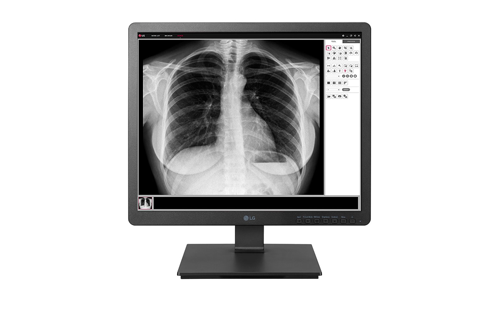 Front view of 1.3MP Clinical Review Monitor, 19HK312C 19HK312C-B