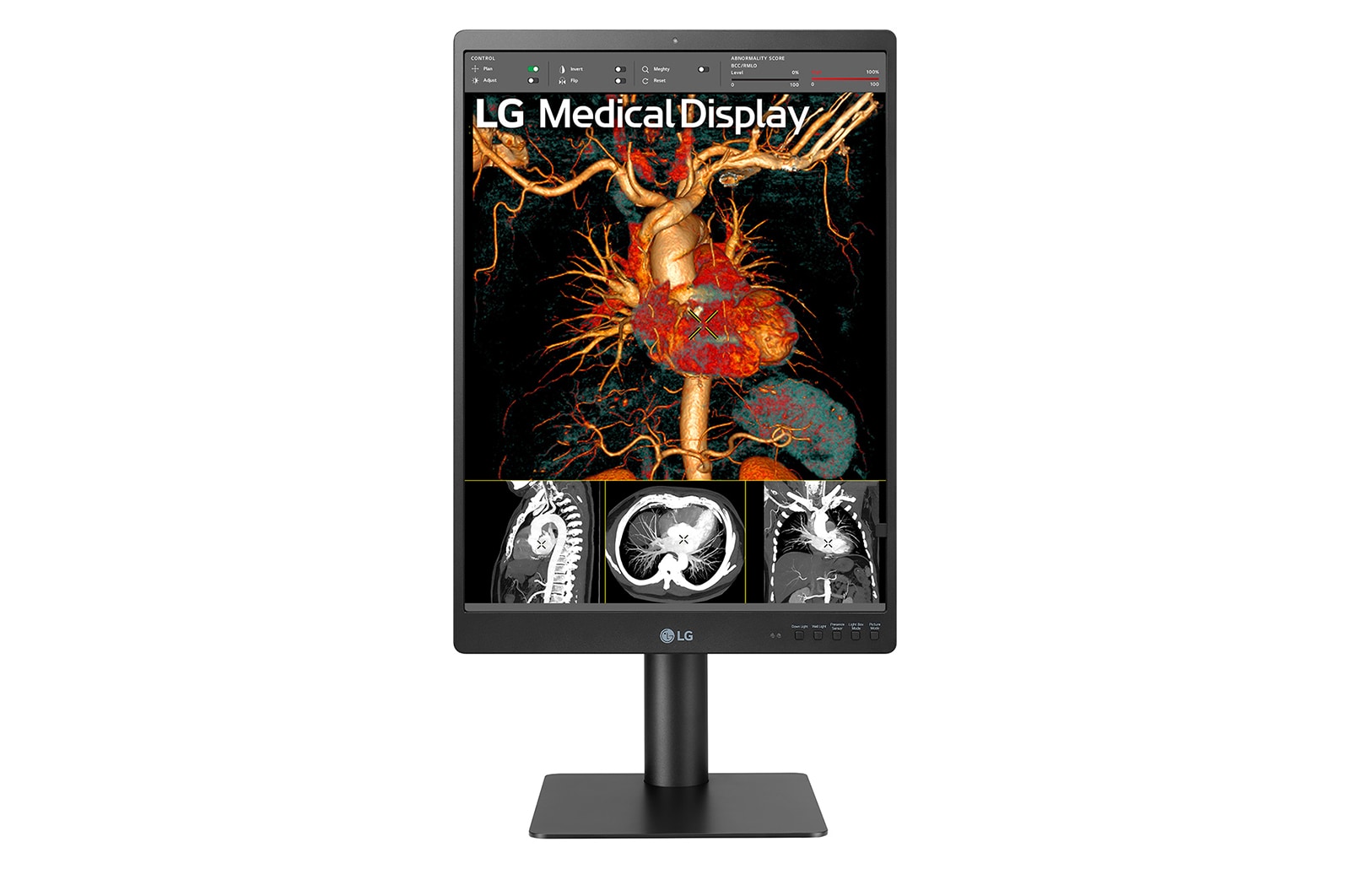 Front view of LG 21.3&#39;&#39; 3MP IPS Diagnostic Monitor 21HQ513D-B